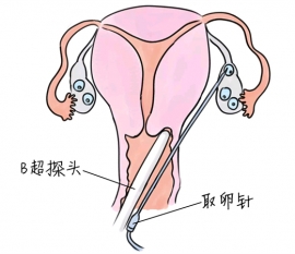 幼儿学画画，中山捐卵宝宝学画画，学画画的好处，如何学画画